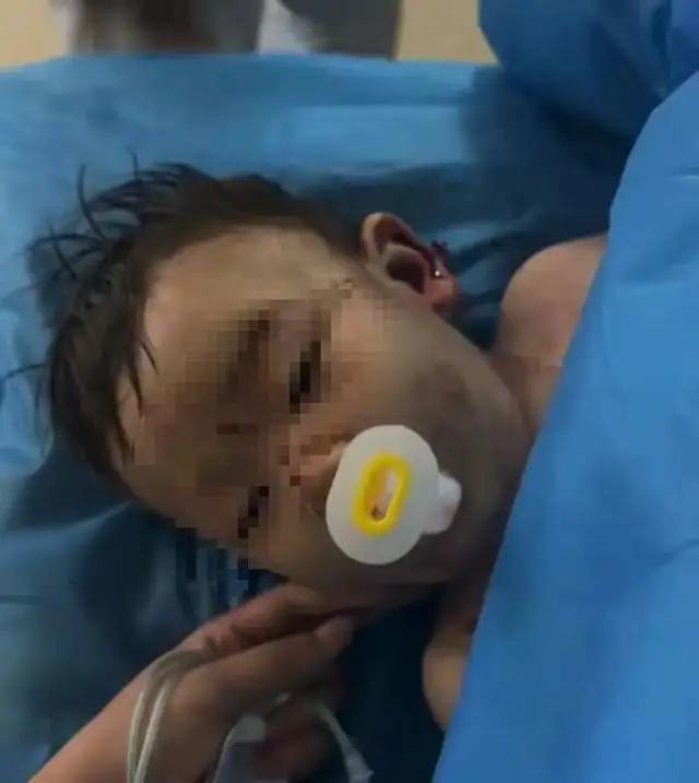 童“睁眼性昏迷”已2个多月其母亲发声；当地披露事故原因j9九游会网址是什么充气滑梯倾倒10人受伤包头2岁男(图2)